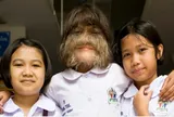 "Cô bé người sói" và hành trình phía sau khiến nhiều người nghẹn lòng
