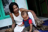Bí ẩn dị nhân biến thành “quái vật rừng” vì căn bệnh lạ kéo dài gần 3 thập kỷ