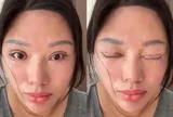 Người phụ nữ 6 năm không thể nhắm mắt khi ngủ, lý do phía sau khiến nhiều người bất ngờ
