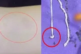 Người phụ nữ đau tay đi khám, bác sĩ kinh ngạc khi thấy thứ bên trong