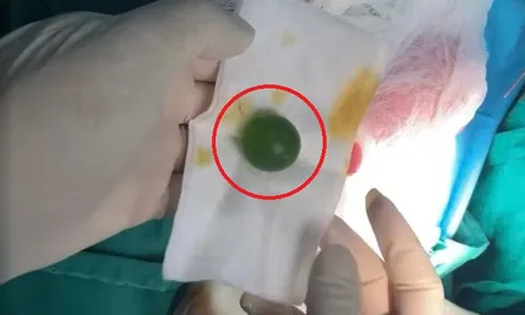 Bé 13 tháng liên tục nôn ói không rõ lý do, sự thật khiến bác sĩ lạnh sống lưng