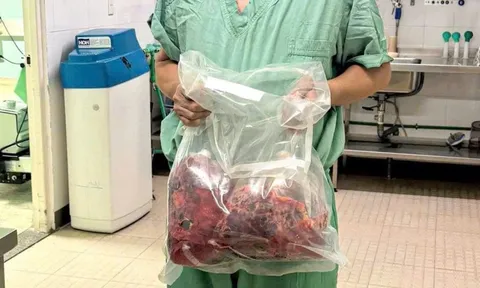 Lần đầu tiên tại Việt Nam: Cắt bỏ hai thận đa nang nặng gần 10kg, ghép thận thành công trong một ca mổ