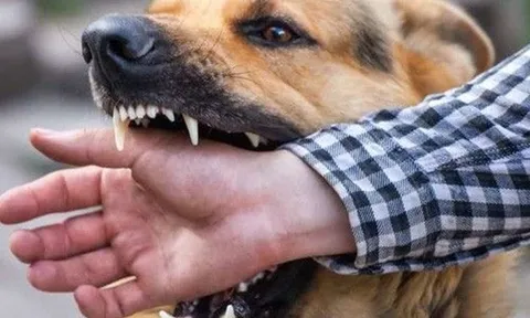 Người đàn ông 63 tuổi tử vong sau khi bị chó cắn lúc tập thể dục