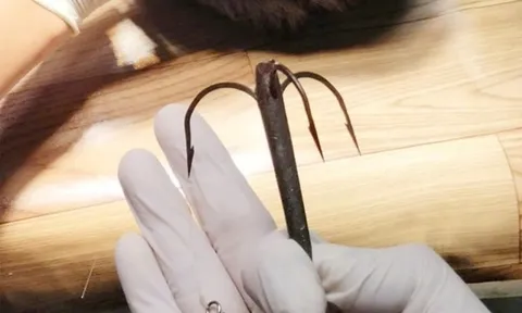 Thiếu niên gặp sự cố hi hữu khi đi câu cá, phải nhập viện xử lý gấp