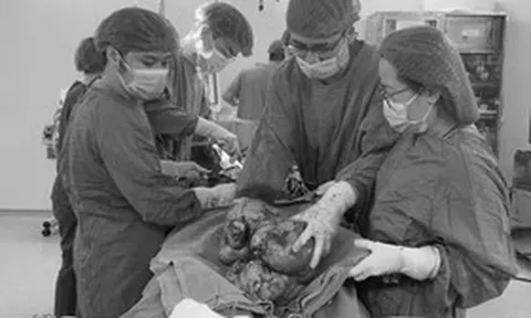 Đau âm ỉ vùng bụng suốt, người phụ nữ sốc khi bác sĩ lấy ra thứ "đáng sợ" trong cơ thể mình