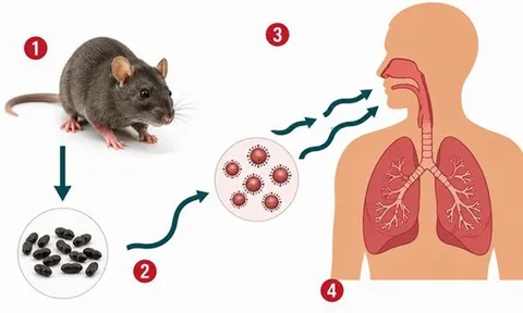 Bộ Y tế phát khuyến cáo khẩn về bệnh do virus Hanta gây ra