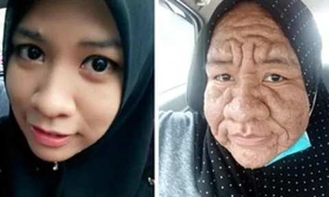 Cô gái 28 tuổi bỗng “già như cụ bà” U80: Bí ẩn phía sau gây bất ngờ