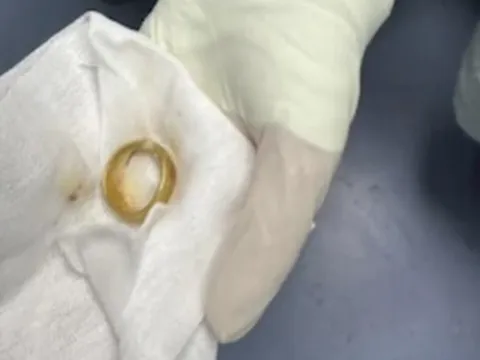 Khám cho cụ ông, bác sĩ phát hiện ra "bí mật" bất ngờ