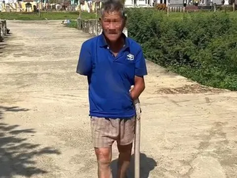 Bị rắn hổ mang cắn, người đàn ông vẫn kẹp chặt con rắn mang về nhà