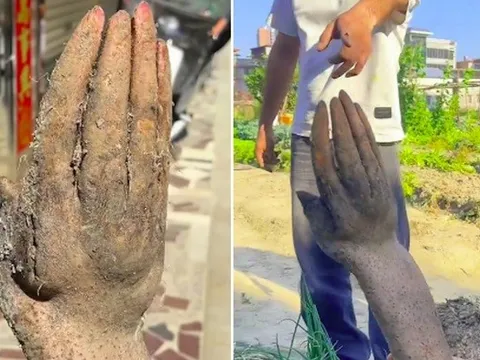 Người đàn ông đào được củ khoai có hình "bàn tay" kỳ lạ