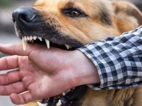 Người đàn ông 63 tuổi tử vong sau khi bị chó cắn lúc tập thể dục