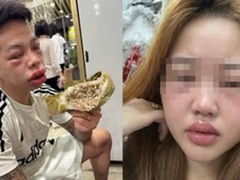 Ăn món "lạ" người phụ nữ mặt sưng húp, bác sĩ chỉ mặt điểm tên lý do cực độc