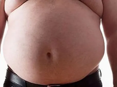 Người đàn ông bụng phình to như "mang thai", bác sĩ lấy ra thứ "đáng sợ" nặng 20kg